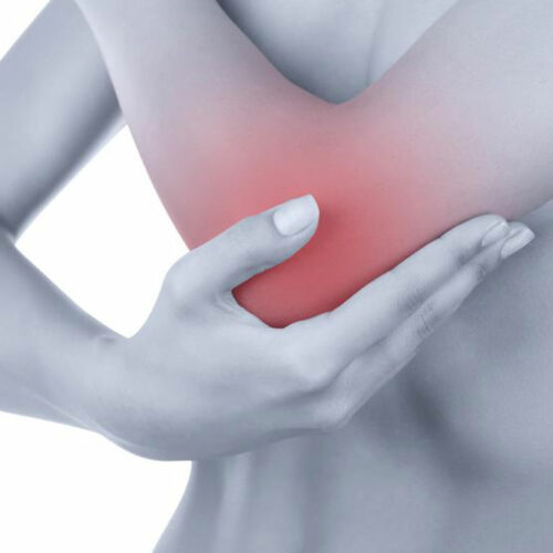 Here’s what you need to know about the causes of bursitis