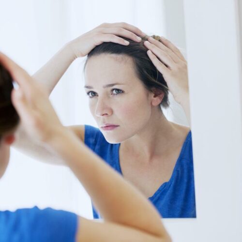 Psoriasis – What you need to know