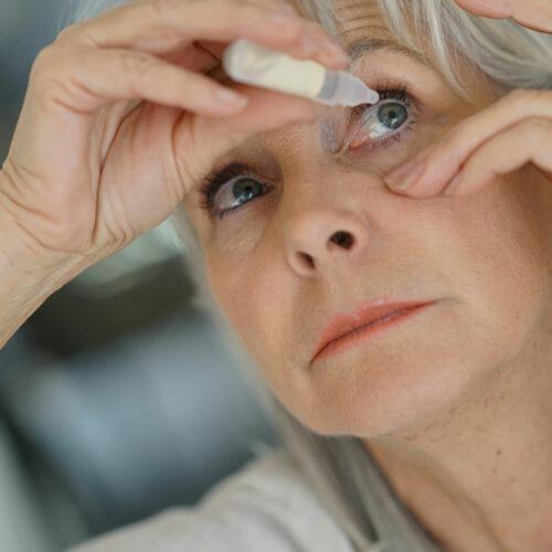 Dry Eyes – Symptoms, Causes, and Treatment Options