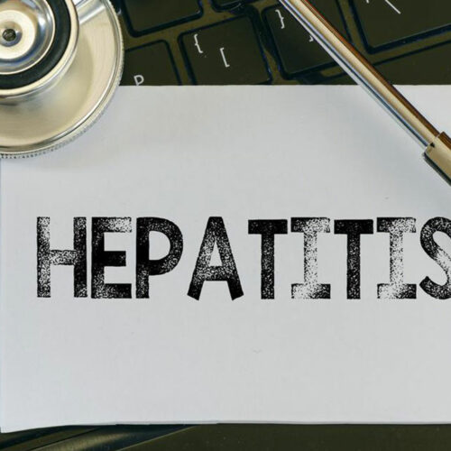 Hepatitis C – Causes, Symptoms, and Treatment