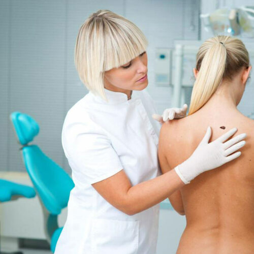 You Probably Didn’t Know That Melanoma Symptoms Can Appear Inside This Delicate Body Part