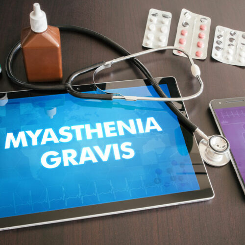 Myasthenia Gravis – Causes, Symptoms, and Prevention Methods